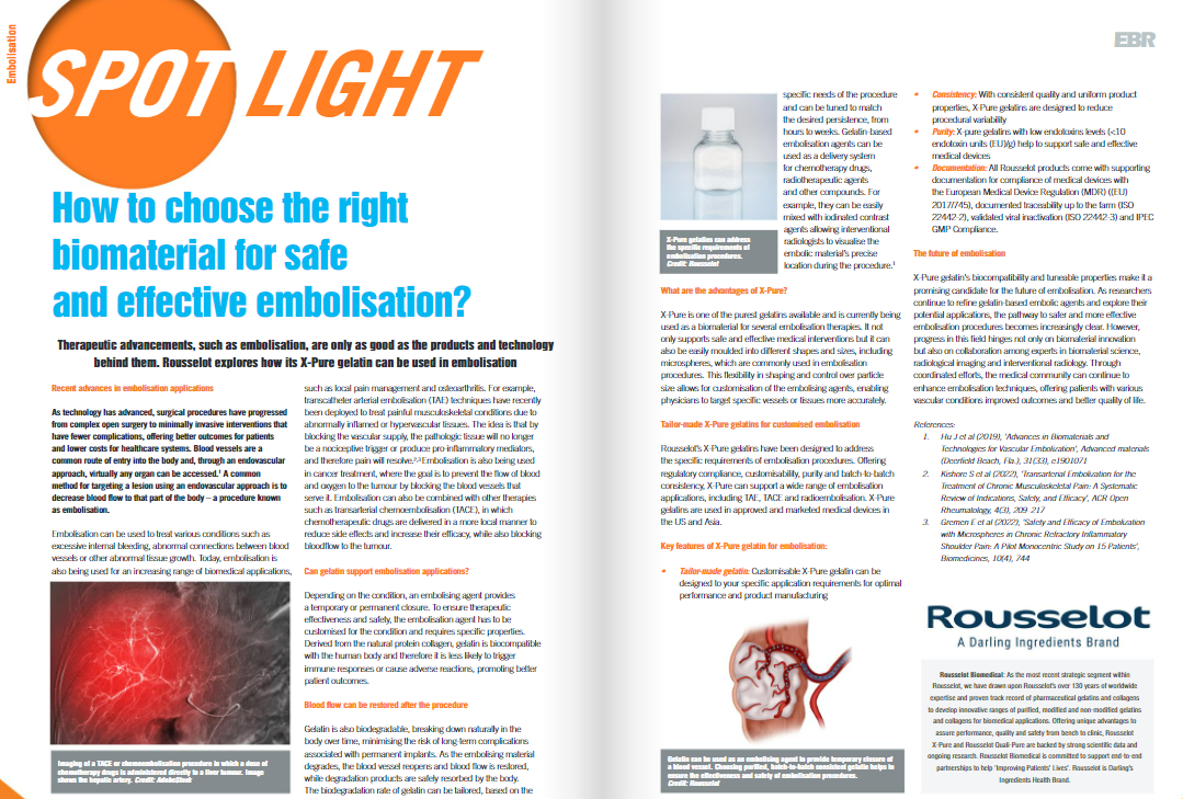 Rousselot embolization article in EBR magazine