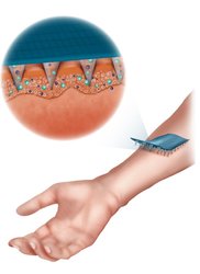 Microneedle gelatin-based solutions at Compamed