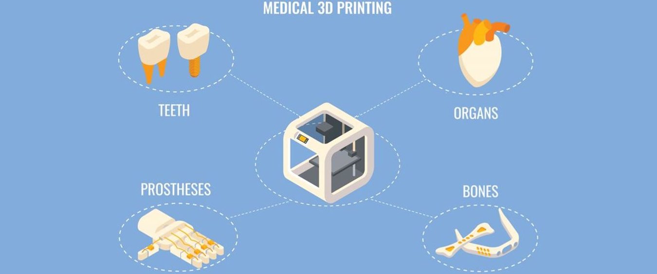[Translate to Spanish:] Medical 3D printing
